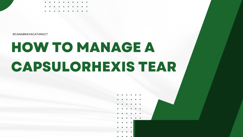 How to manage a capsulorhexis tear
